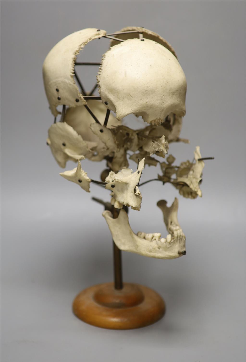 A human skull specimen, 1920s-30s, mounted in exploded form, adjustable brass arms and oak base, 40cm high